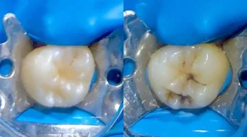 Центр эстетической стоматологии и имплантации Dr.Kamaev (SL Dental Clinic) изображение 3