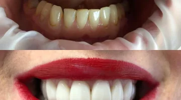 Центр эстетической стоматологии и имплантации Dr.Kamaev (SL Dental Clinic) изображение 2