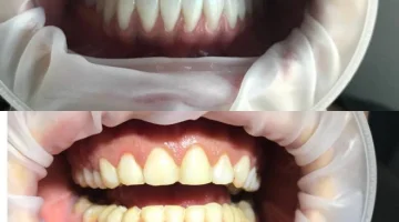 Центр эстетической стоматологии и имплантации Dr.Kamaev (SL Dental Clinic) изображение 10