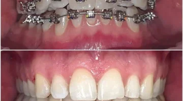 Центр эстетической стоматологии и имплантации Dr.Kamaev (SL Dental Clinic) изображение 18