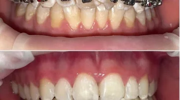 Центр эстетической стоматологии и имплантации Dr.Kamaev (SL Dental Clinic) изображение 19