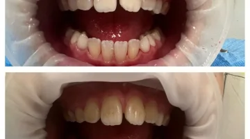 Центр эстетической стоматологии и имплантации Dr.Kamaev (SL Dental Clinic) изображение 20