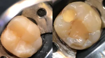 Центр эстетической стоматологии и имплантации Dr.Kamaev (SL Dental Clinic) изображение 4