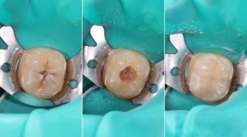 Центр эстетической стоматологии и имплантации Dr.Kamaev (SL Dental Clinic) изображение 17