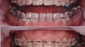 Центр эстетической стоматологии и имплантации Dr.Kamaev (SL Dental Clinic) изображение 9