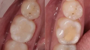 Центр эстетической стоматологии и имплантации Dr.Kamaev (SL Dental Clinic) изображение 16