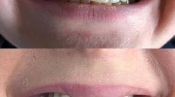 Центр эстетической стоматологии и имплантации Dr.Kamaev (SL Dental Clinic) изображение 15
