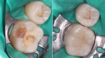Центр эстетической стоматологии и имплантации Dr.Kamaev (SL Dental Clinic) изображение 1