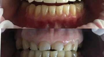 Центр эстетической стоматологии и имплантации Dr.Kamaev (SL Dental Clinic) изображение 7