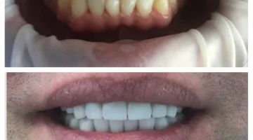 Центр эстетической стоматологии и имплантации Dr.Kamaev (SL Dental Clinic) изображение 11