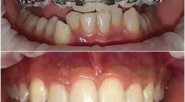 Центр эстетической стоматологии и имплантации Dr.Kamaev (SL Dental Clinic) изображение 15