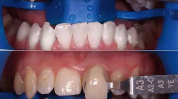 Центр эстетической стоматологии и имплантации Dr.Kamaev (SL Dental Clinic) изображение 10