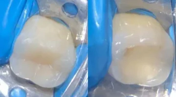 Центр эстетической стоматологии и имплантации Dr.Kamaev (SL Dental Clinic) изображение 18