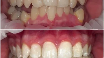 Центр эстетической стоматологии и имплантации Dr.Kamaev (SL Dental Clinic) изображение 14