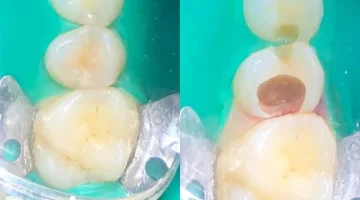 Центр эстетической стоматологии и имплантации Dr.Kamaev (SL Dental Clinic) изображение 19