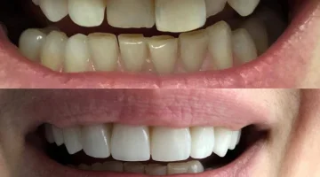 Центр эстетической стоматологии и имплантации Dr.Kamaev (SL Dental Clinic) изображение 13