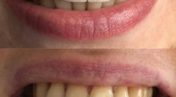 Центр эстетической стоматологии и имплантации Dr.Kamaev (SL Dental Clinic) изображение 8