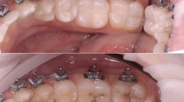 Центр эстетической стоматологии и имплантации Dr.Kamaev (SL Dental Clinic) изображение 2
