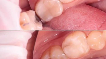 Центр эстетической стоматологии и имплантации Dr.Kamaev (SL Dental Clinic) изображение 12