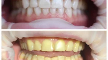 Центр эстетической стоматологии и имплантации Dr.Kamaev (SL Dental Clinic) изображение 4