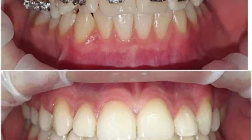 Центр эстетической стоматологии и имплантации Dr.Kamaev (SL Dental Clinic) изображение 16