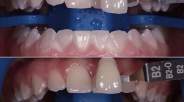 Центр эстетической стоматологии и имплантации Dr.Kamaev (SL Dental Clinic) изображение 6