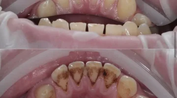 Центр эстетической стоматологии и имплантации Dr.Kamaev (SL Dental Clinic) изображение 18