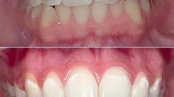 Центр эстетической стоматологии и имплантации Dr.Kamaev (SL Dental Clinic) изображение 15