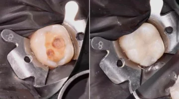 Центр эстетической стоматологии и имплантации Dr.Kamaev (SL Dental Clinic) изображение 18