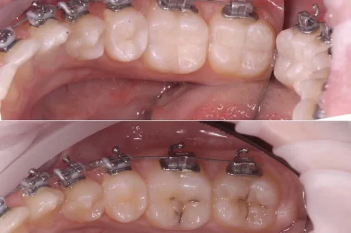 Центр эстетической стоматологии и имплантации Dr.Kamaev (SL Dental Clinic) изображение 2